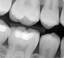 Dental Radiography